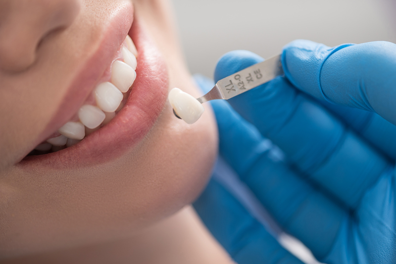 Làm răng sứ – hiệu quả thẩm mỹ và chức năng nhai cao – hàm răng sáng đẹp tự nhiên » Nhakhoahoanmyhcm