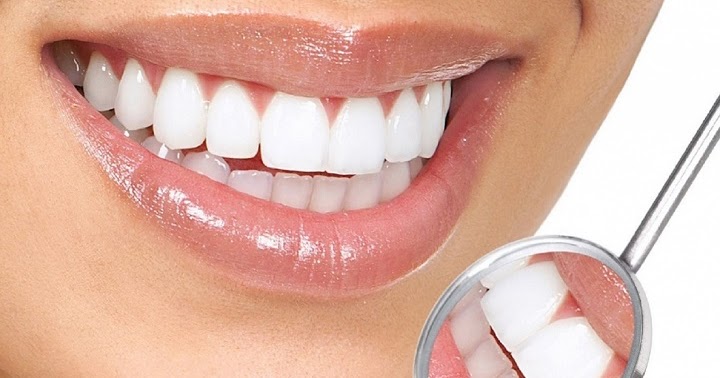 Làm cầu răng sứ sử dụng được bao lâu?