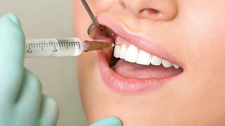 Chi phí nhổ răng tại phú nhuận sao rẻ vậy? » Nhakhoahoanmyhcm