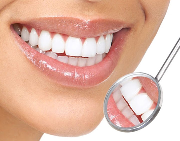 Răng sứ kim loại là gì? Răng sứ cromcoban  có tốt không? » Nhakhoahoanmyhcm