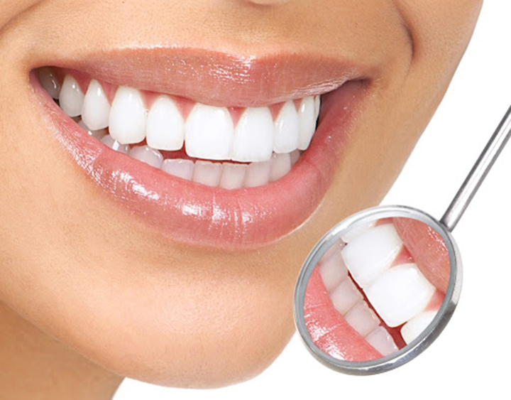 Bọc răng sứ có thực sự mang lại kết quả vĩnh viễn như quảng cáo? – Nha Khoa Hoàn Mỹ