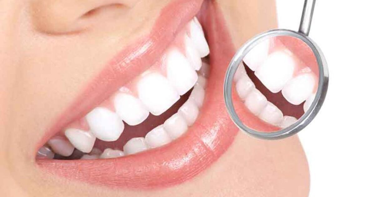 Tẩy trắng răng có cần thiết không?
