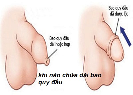 Phòng khám chữa dài bao quy đầu uy tín tại An Giang - Phòng Khám Đa Khoa An Giang