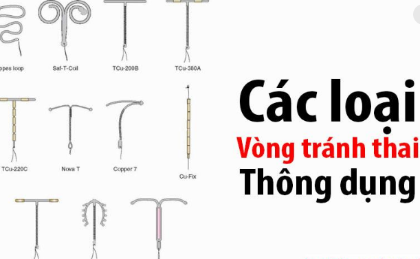 Có Mấy Loại Vòng Tránh Thai? - Tư Vấn Bệnh Học