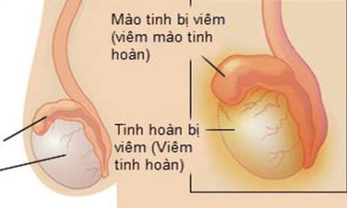 Phòng khám chữa viêm tinh hoàn uy tín tại An Giang - Phòng Khám Đa Khoa An Giang