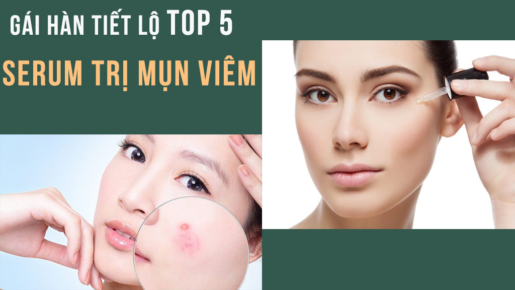 "Bánh bèo" Hàn Quốc da đẹp rụng rời là nhờ 5 serum trị mụn viêm này