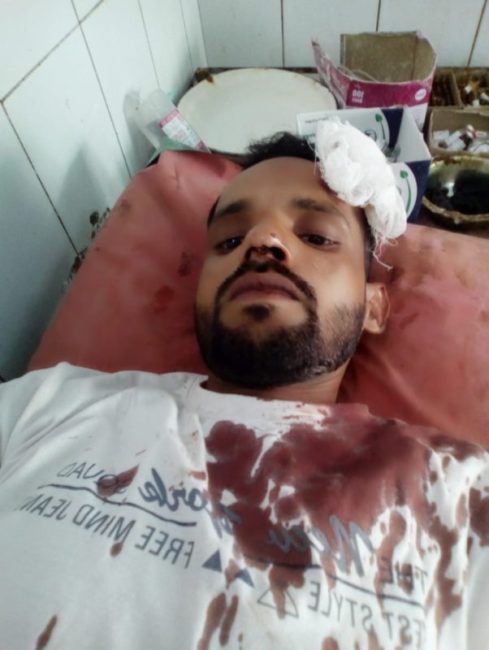 पत्रकार मो तैय्यब के भाई पर हुआ जानलेवा हमला गंभीर रूप से घायल - Hindustan News