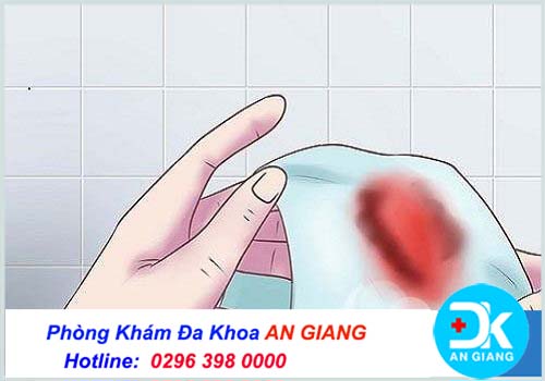 Kinh nguyệt vón cục ở phụ nữ do những nguyên nhân nào?