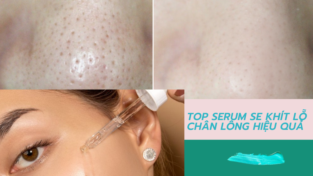 Top 5 Serum se khít lỗ chân lông xịn sò hiệu quả được các tín đồ mê mệt