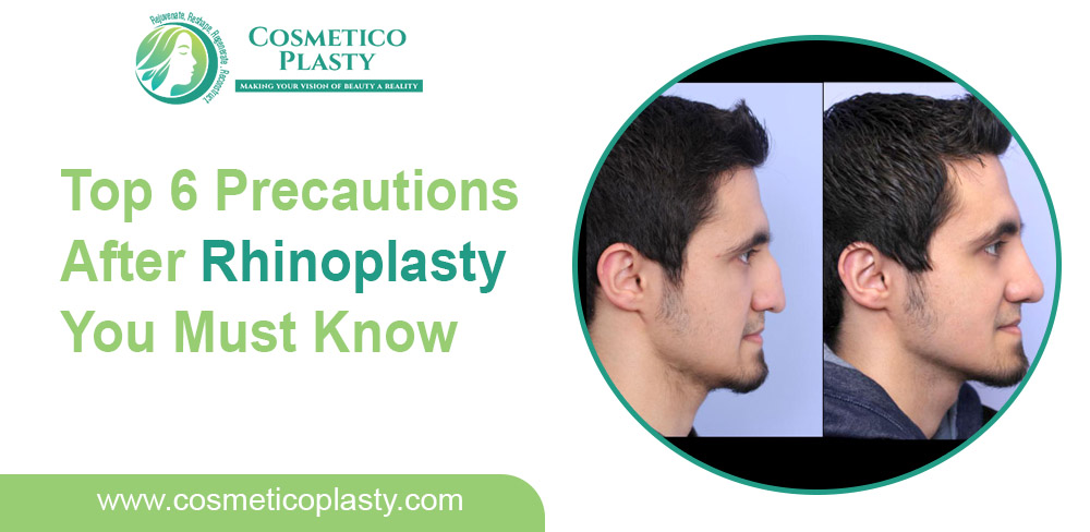 Top 6 precautions after rhinoplasty you must know