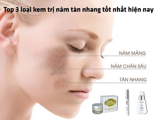 Review top 10 kem trị nám tàn nhang tốt nhất hiện nay