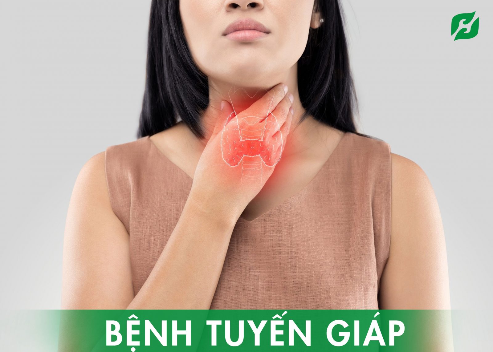 Nguyên nhân, biểu hiện ung thư tuyến giáp giai đoạn 1 - H&H Nutrition