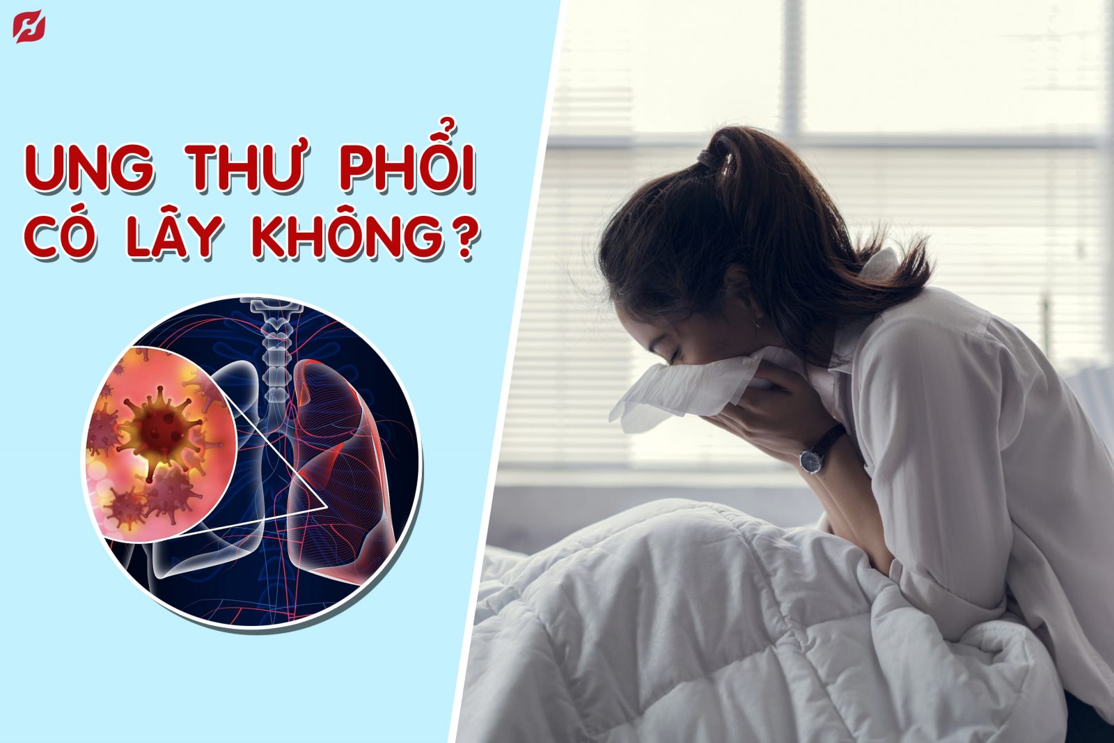 Ung thư phổi có lây không? Nguyên tắc dinh dưỡng cho người ung thư phổi  - H&H Nutrition