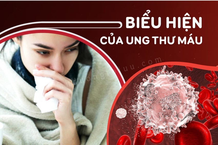 Nhận biết biểu hiện của ung thư máu - H&H Nutrition