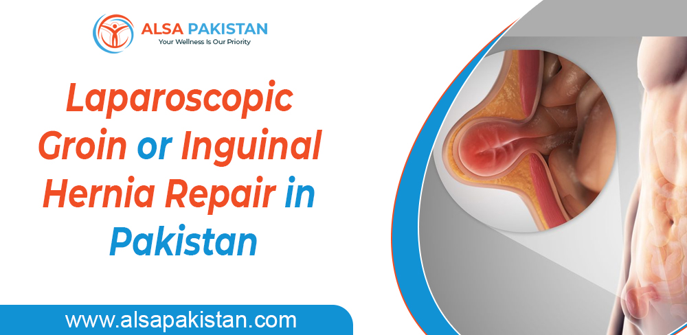 Laparoscopic Groin or Inguinal Hernia Repair in Pakistan
