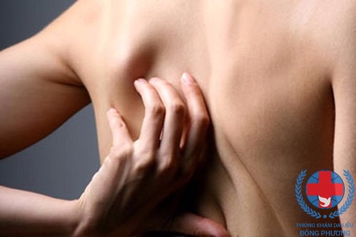 Bệnh ngứa lưng - Làm sao cho hết ngứa ? - Tìm giải đáp