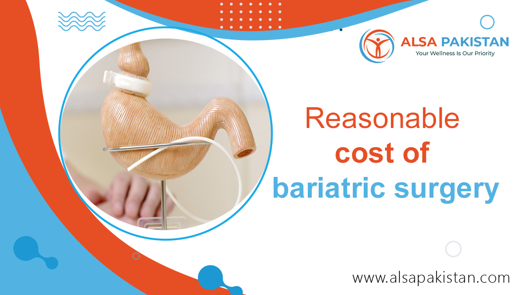 Reasonable cost of bariatric surgery