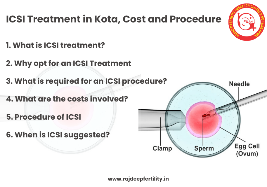 ICSI Treatment in Kota, Cost and Procedure | IVF Treatment