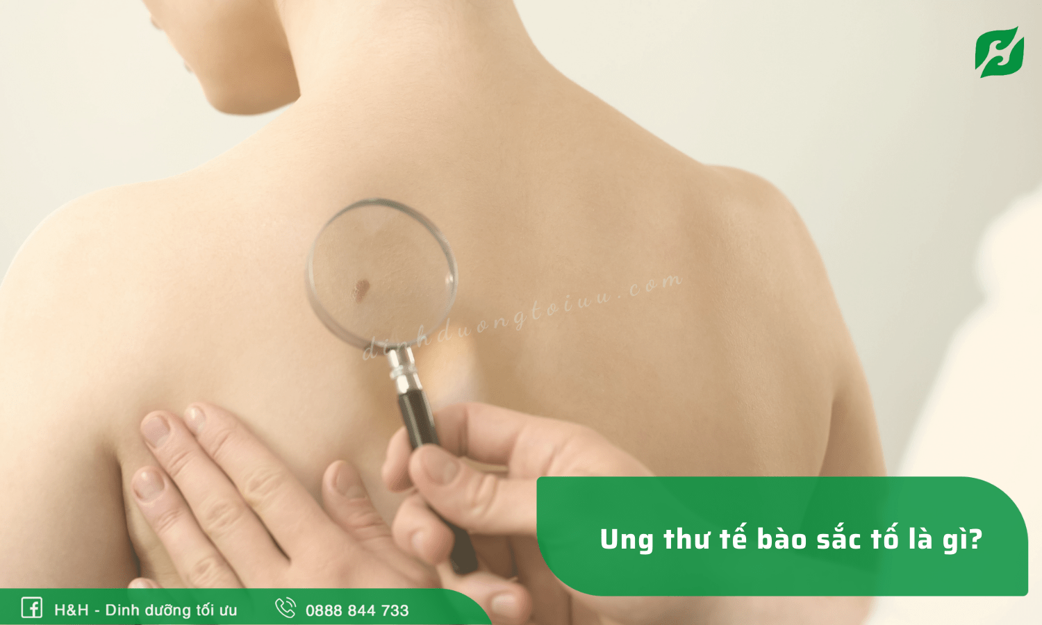 Ung thư tế bào hắc tố là gì? Nhóm thực phẩm người ung thư tế bào sắc tố nên chọn - H&H Nutrition