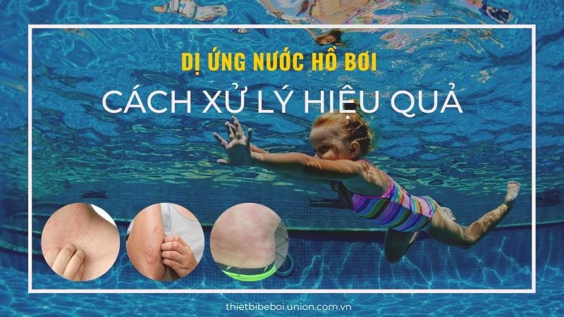 Dị ứng nước hồ bơi - Đi bơi về bị [NGỨA] làm thế nào?