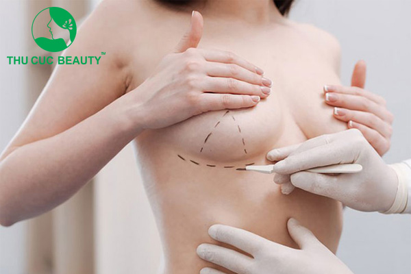 Top 10 địa chỉ nâng ngực tại Hà Nội - Thẩm mỹ Thu Cúc