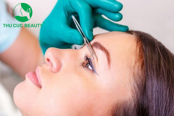 Cắt mí bao lâu thì hết sẹo - Thẩm mỹ Thu Cúc