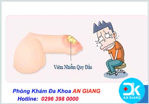 Nguyên nhân bao quy đầu sưng đỏ và ngứa