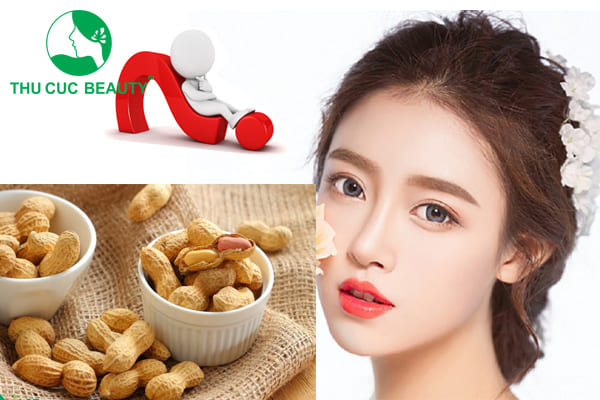 Cắt mí có được ăn đậu phộng không? - Thu Cúc Sài Gòn