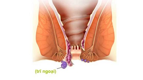 Đau hậu môn là bệnh gì? Cách điều trị triệt để? | Phòng Khám Đa Khoa An Giang