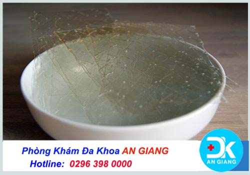 Cách làm chậm kinh 1 tuần an toàn và hiệu quả - Phòng Khám Đa Khoa An Giang