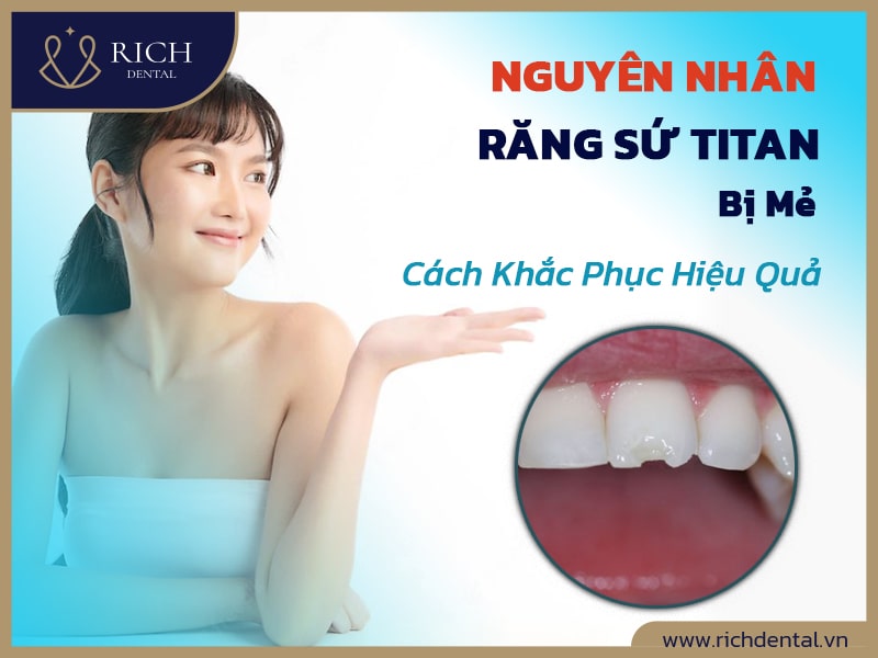 Nguyên Nhân Răng Sứ Titan Bị Mẻ và Cách Khắc Phục Hiệu Quả