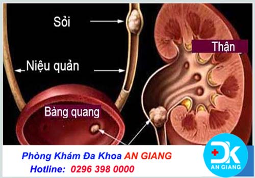 U xơ tiền liệt tuyến có nguy hiểm không?