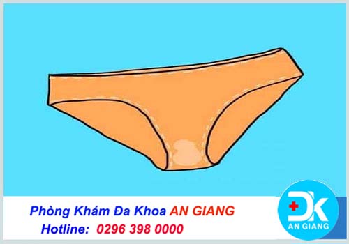 Quần lót nữ dính chất nhờn là bị gì? Cách chữa trị - Phòng Khám Đa Khoa An Giang