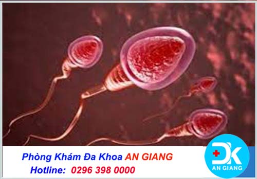 Tinh trùng có màu hồng nhạt là dấu hiệu gì? Cần thăm khám gì | Phòng Khám Đa Khoa An Giang