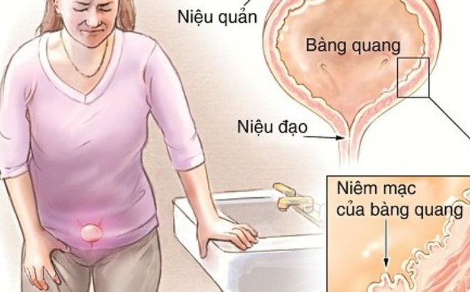[Tìm hiểu] Bị viêm bàng quang sau sinh ở phụ nữ - Phòng Khám Đa Khoa An Giang