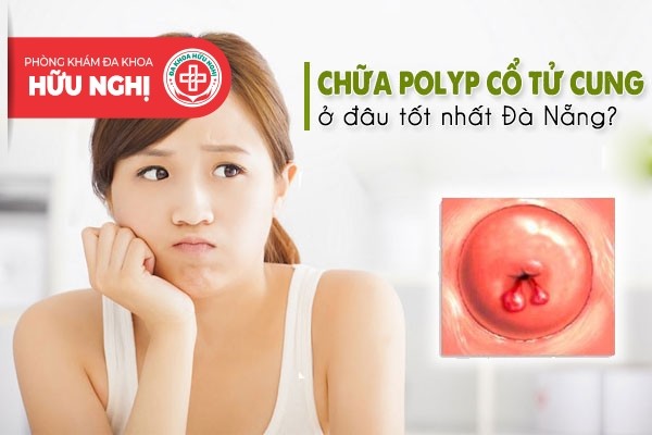 Khám chữa bệnh polyp cổ tử cung ở đâu tốt nhất tại An Giang | Phòng Khám Đa Khoa An Giang