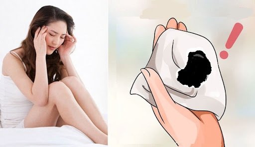 [Khí hư màu đen] Dấu hiệu 11 bệnh phụ khoa nguy hiểm + Cách điều trị