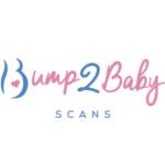 bump2baby scans