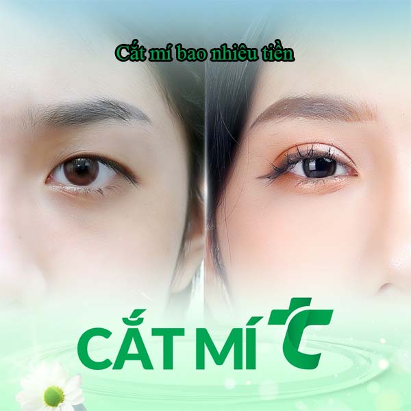 Cắt mí bao nhiêu tiền? - Thu Cúc Sài Gòn