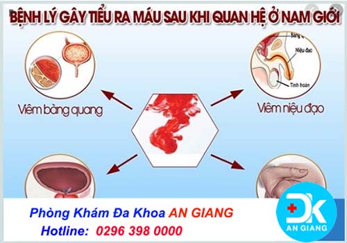 Nguyên nhân hiện tượng đi tiểu buốt sau khi quan hệ. Cách chữa trị hiệu quả | Phòng Khám Đa Khoa An Giang