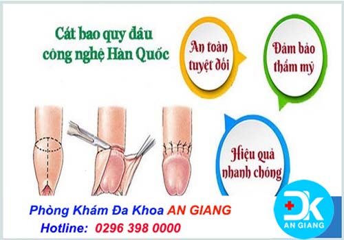 Cắt bao quy đầu công nghệ Hàn Quốc là như thế nào? Có an toàn không? | Phòng Khám Đa Khoa An Giang