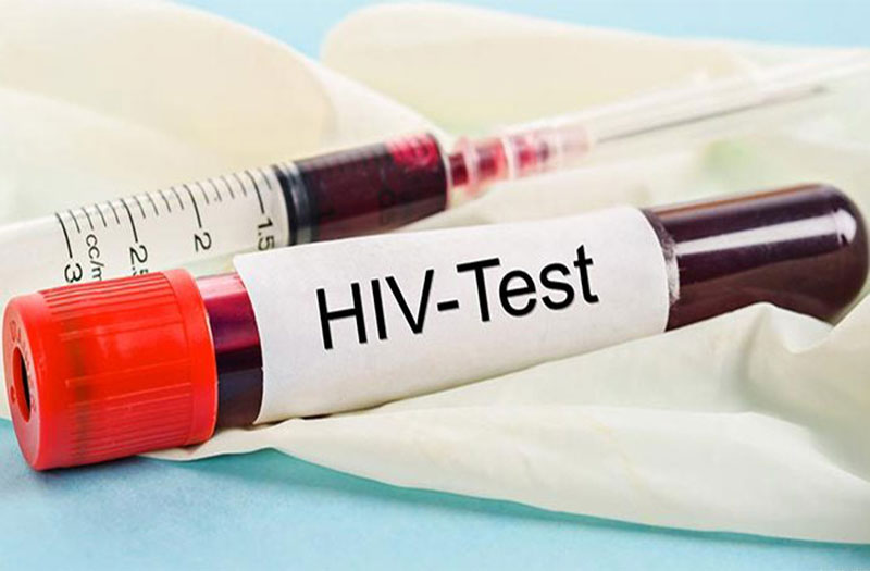 Nên xét nghiệm HIV ở đâu uy tín và đảm bảo chất lượng? - Phòng Khám Đa Khoa An Giang