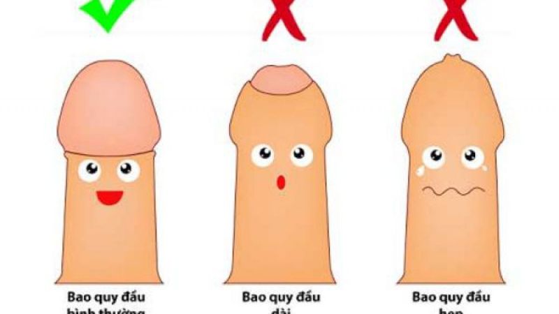 Rách da bao quy đầu – những thông tin hữu ích