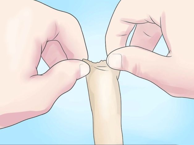 Video hướng dẫn cách lột bao quy đầu tại nhà 