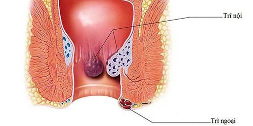 #Địa chỉ cắt trĩ uy tín tin cậy tại Long An - Phòng Khám Nam Khoa An Giang
