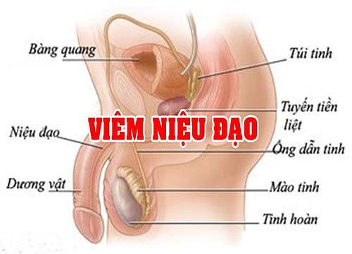 Những điều cần biết về viêm niệu đạo không lậu