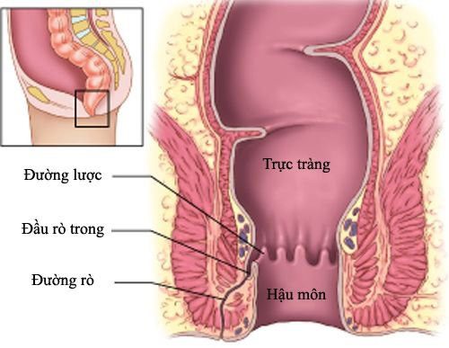 ✲Địa chỉ chữa bệnh rò hậu môn uy tín tại Bạc Liêu