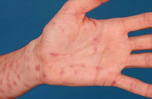 #Địa chỉ xét nghiệm giang mai uy tín tin cậy tại Tiền Giang - Phòng Khám Nam Khoa An Giang