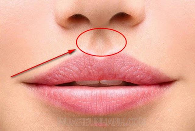 Nhân trung là gì? Nốt ruồi ở nhân trung có tốt không? - Chia sẻ thông tin mua sắm online nhanh và rẻ nhất
