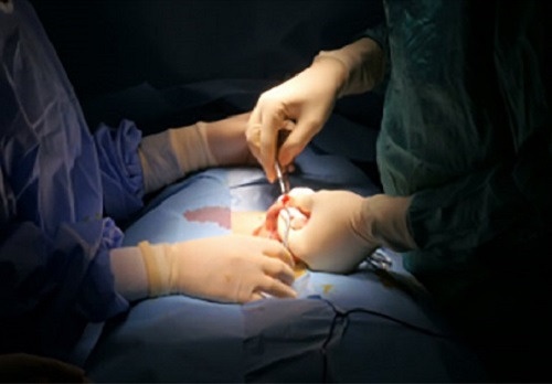 Nhiễm trùng vết cắt bao quy đầu và cách phòng tránh - Phòng Khám Đa Khoa An Giang